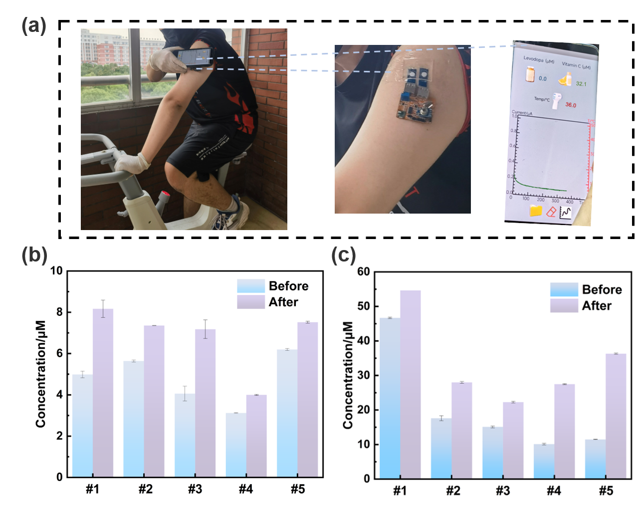 图3 (a) 在体实验示意图。(b) 五名志愿者餐后汗液中左旋多巴浓度的变化。(c)五名志愿者餐后汗液中维生素 C 浓度的变化。.png